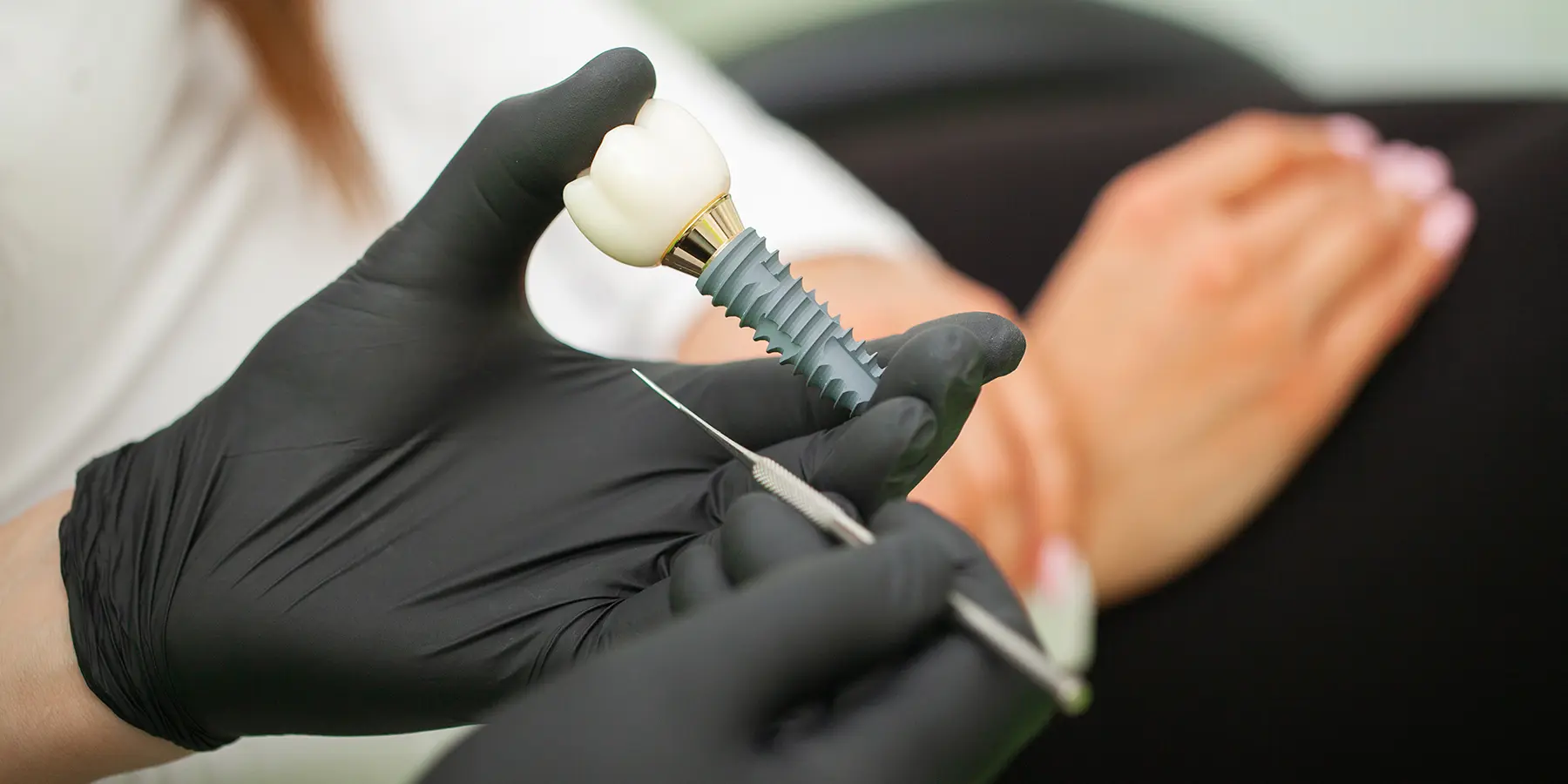 Dental Implant Surgery: Does It Hurt?