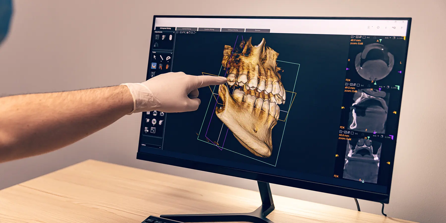 The Benefits of 3D Dental Imaging