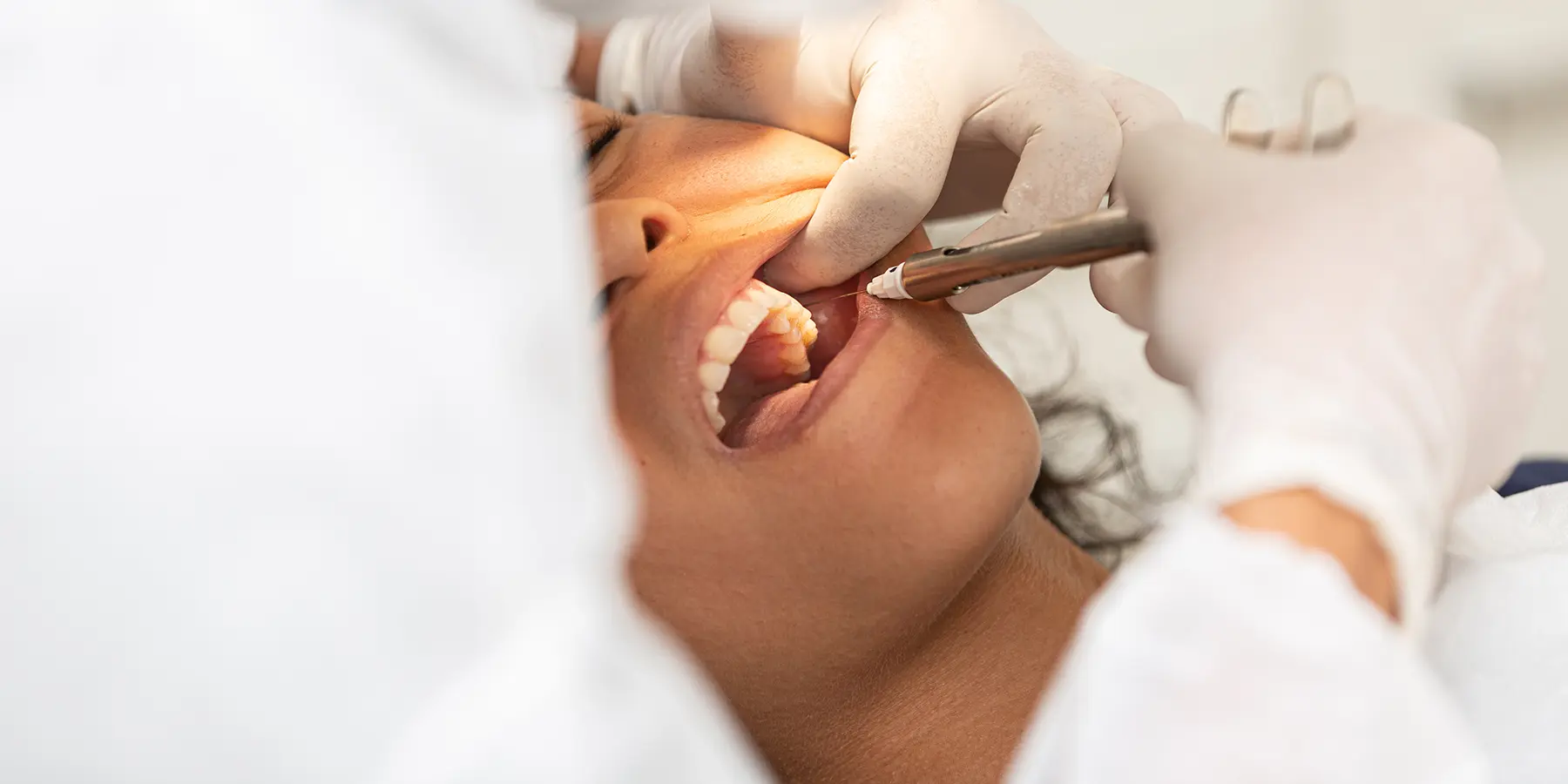 Outsmart Your Wisdom Teeth: Know When It's Time to Say Goodbye