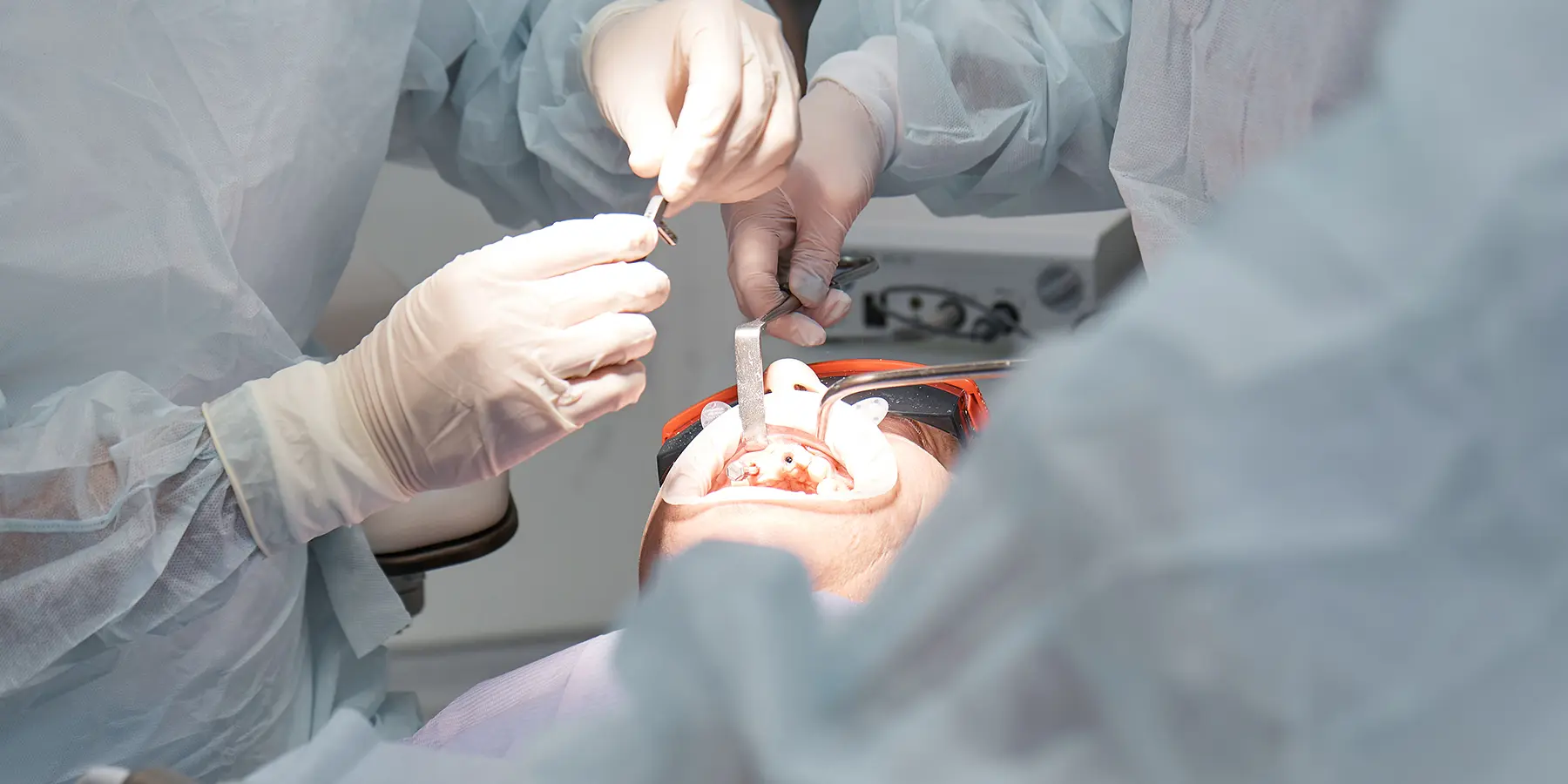 How Can I Find a Highly-Rated Oral Surgeon in Boulder?