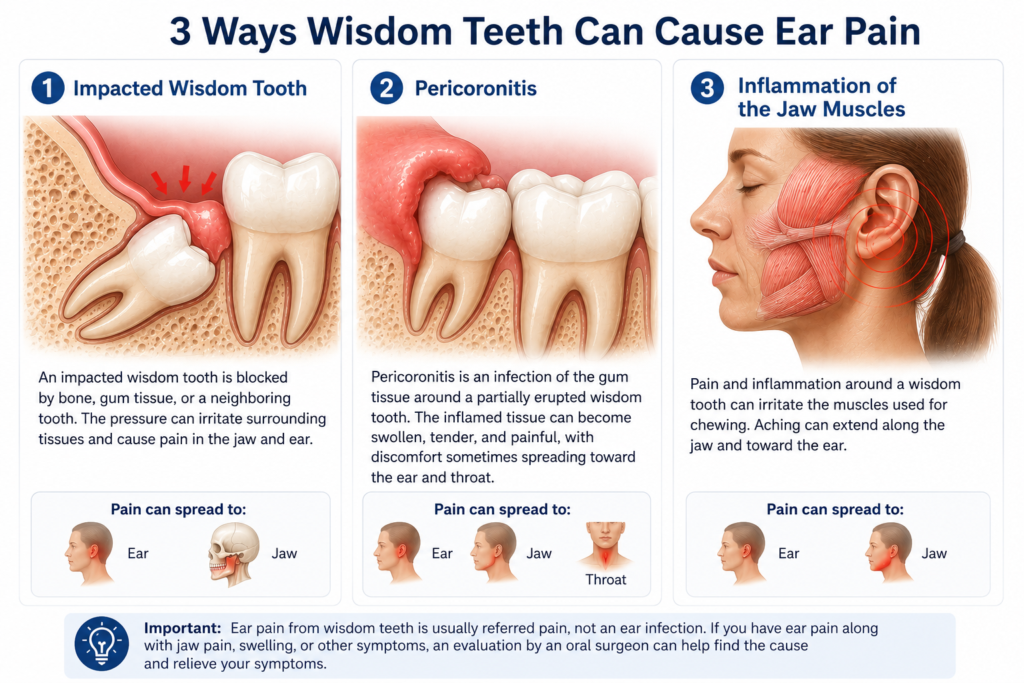 Illustration showing three ways wisdom teeth can cause ear pain: impacted wisdom teeth, pericoronitis, and jaw muscle inflammation.