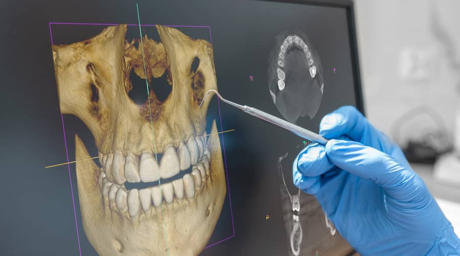 3D Dental Imaging