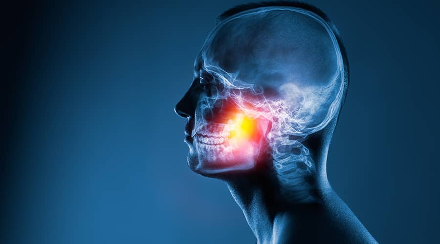 Jaw Surgery Instructions