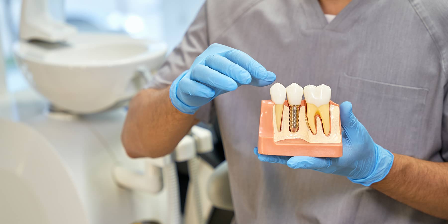 When Are Bone Grafts Necessary for Dental Implants?