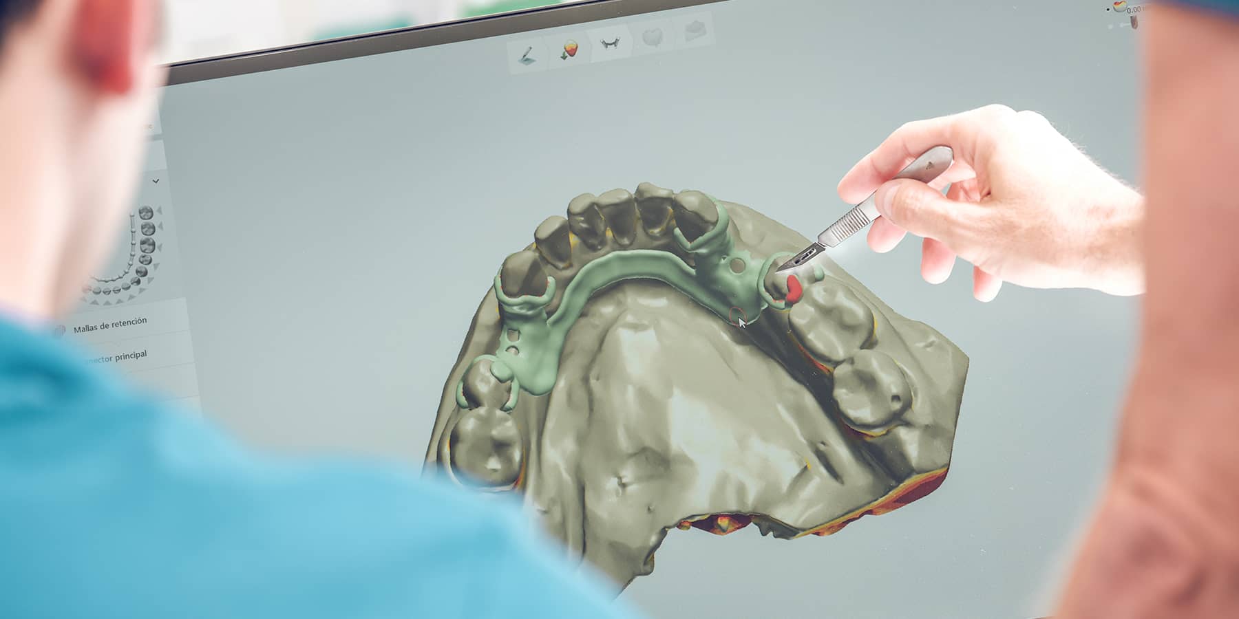 Understanding the Four Types of Jaw Misalignment
