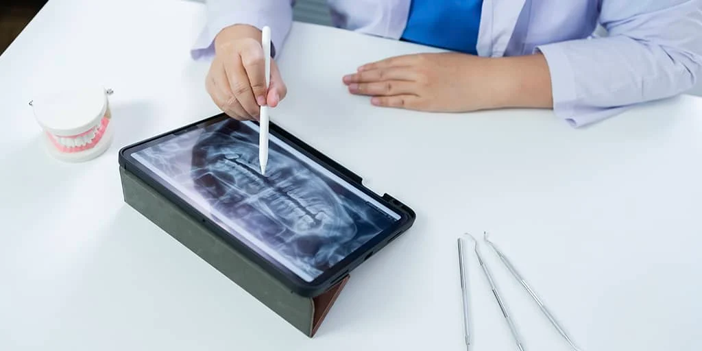 Maxillofacial Surgery vs. Oral Surgery