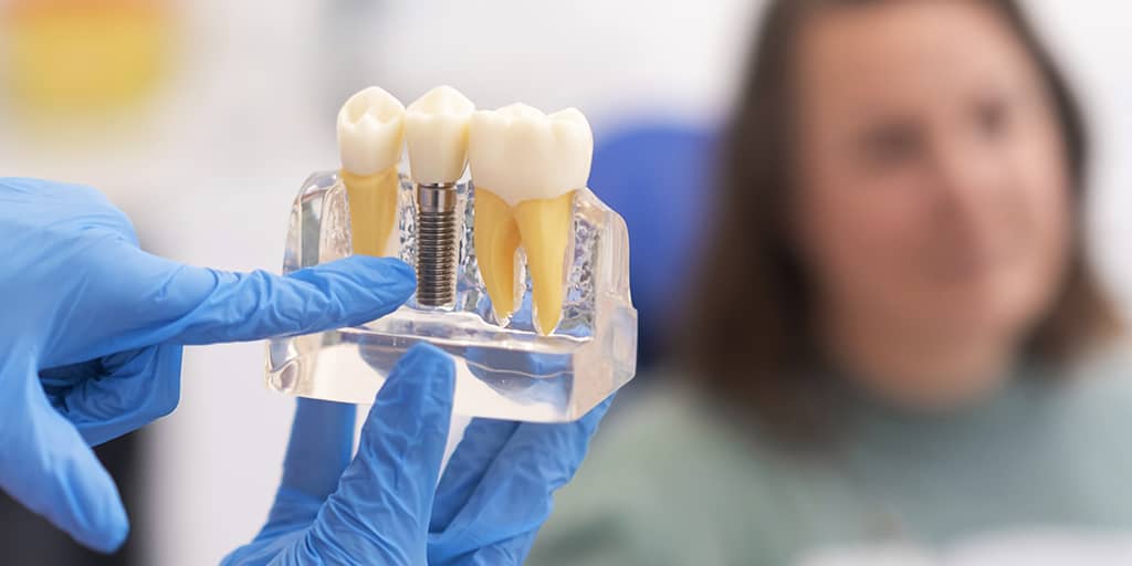 The Science Behind Dental Implants: Understanding Osseointegration