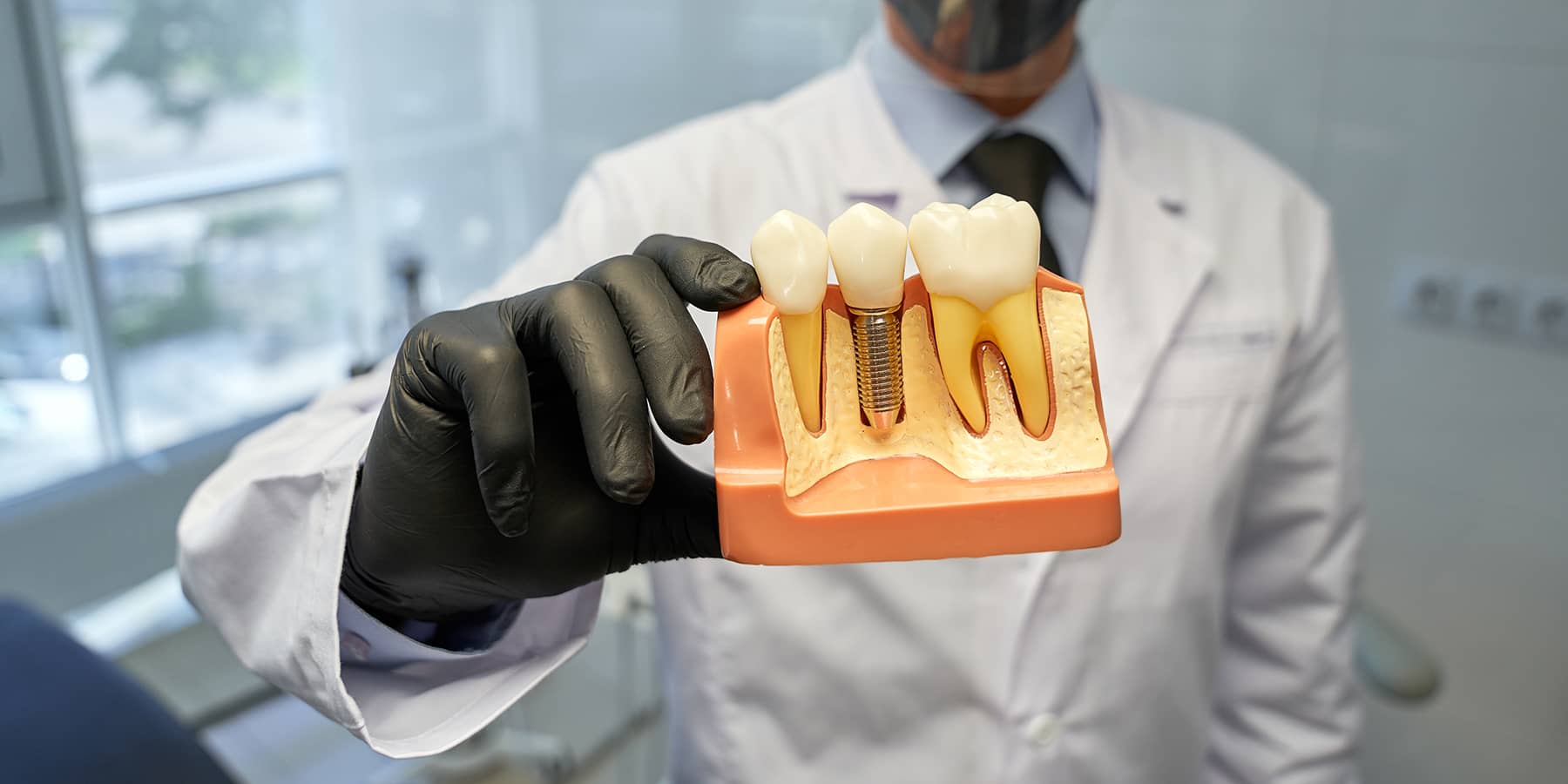 Are Dental Implants Right for You?