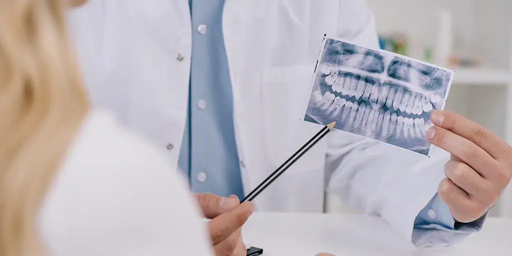 Advantages and Disadvantages of Removing Wisdom Teeth