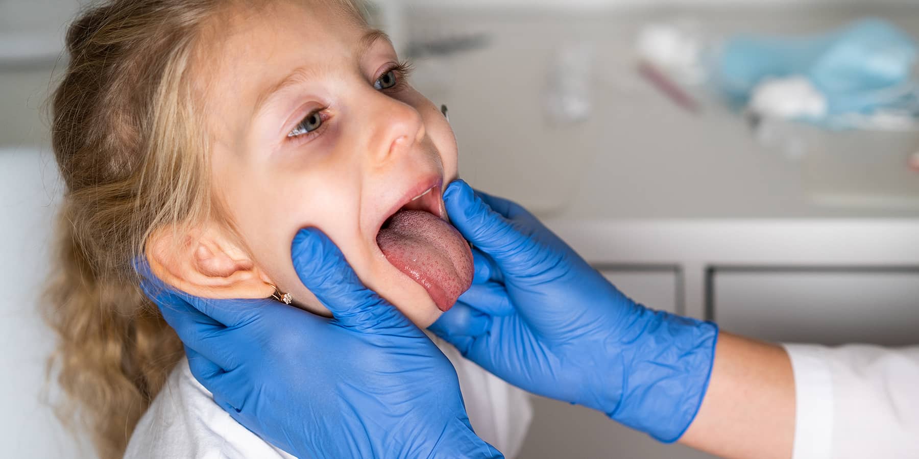 Frenectomy Procedure Explained