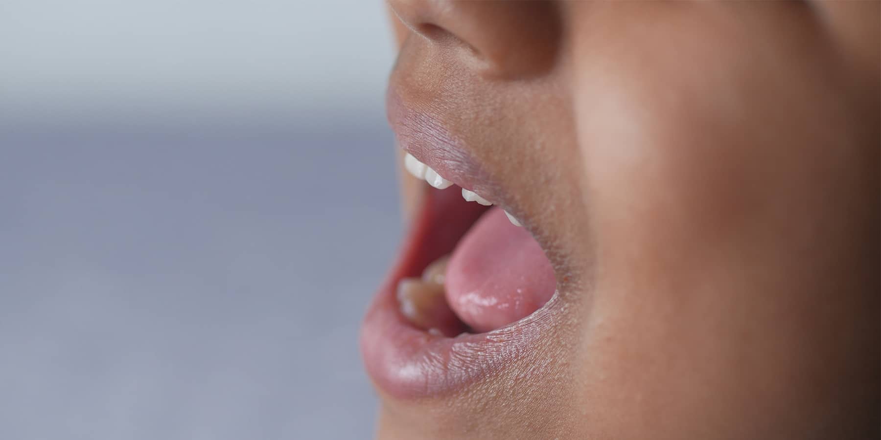 Understanding Lip and Tongue Ties